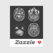 MRT des Gehirns Aufkleber (Blatt)