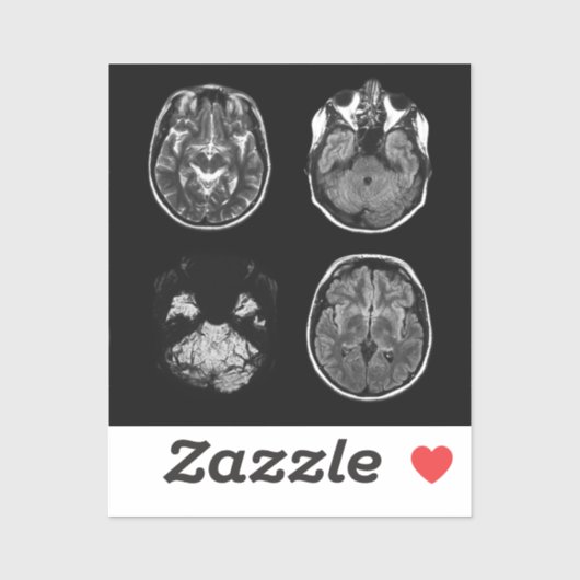 MRT des Gehirns Aufkleber (Blatt)