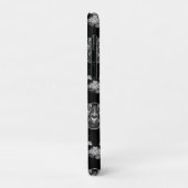 MRT des Gehirns Case-Mate iPhone Hülle (Hinten/Links)