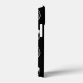 MRT des Gehirns Case-Mate iPhone Hülle (Rückseite / Rechts)