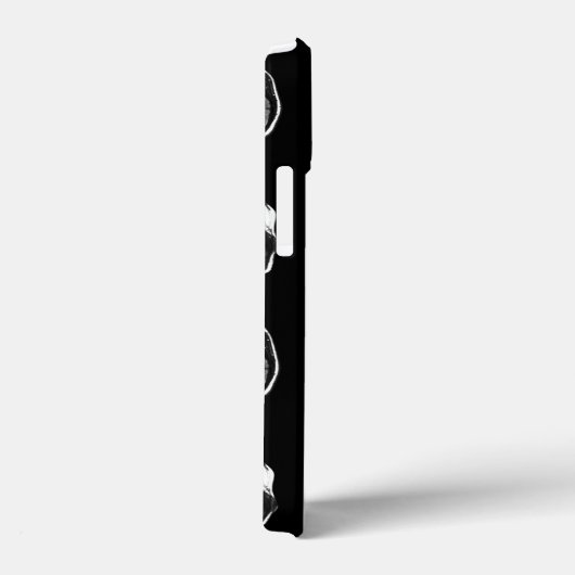 MRT des Gehirns Case-Mate iPhone Hülle (Rückseite / Rechts)