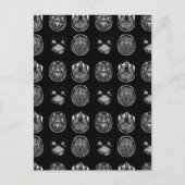 MRT des Gehirns Feiertagspostkarte (Vorderseite)