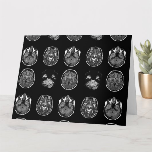 MRT des Gehirns Karte (Kleine Pflanze)