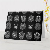 MRT des Gehirns Karte (Gelbe Blume)