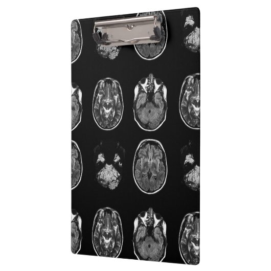 MRT des Gehirns Klemmbrett (Links)