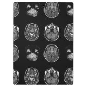 MRT des Gehirns Klemmbrett (Rückseite)