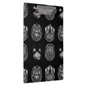 MRT des Gehirns Klemmbrett (Rechts)