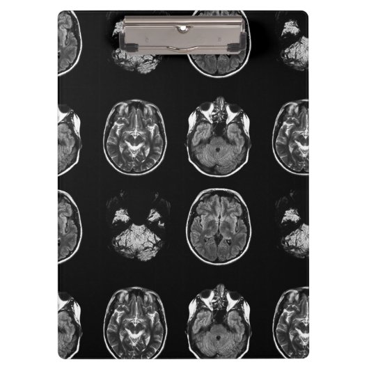 MRT des Gehirns Klemmbrett (Vorderseite)