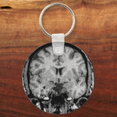 MRT des Gehirns, koronale Scheibe Schlüsselanhänger (Vorderseite)
