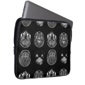 MRT des Gehirns Laptopschutzhülle (Vorne Rechts)