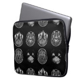 MRT des Gehirns Laptopschutzhülle (Vorderseite Links)