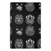 MRT des Gehirns Mini Klemmbrett (Rückseite)