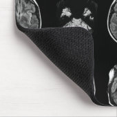 MRT des Gehirns Mousepad (Ecke)