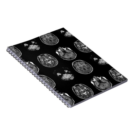 MRT des Gehirns Notizblock (Rechte Seite)