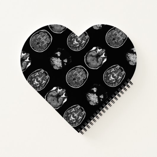 MRT des Gehirns Notizblock (Rückseite)