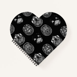 MRT des Gehirns Notizblock