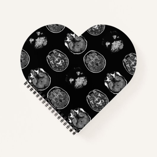 MRT des Gehirns Notizblock (Vorderseite)