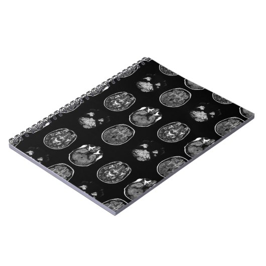 MRT des Gehirns Notizblock (Linke Seite)