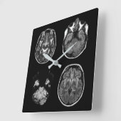 MRT des Gehirns Quadratische Wanduhr (Winkel)