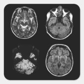 MRT des Gehirns Quadratischer Aufkleber (Vorderseite)