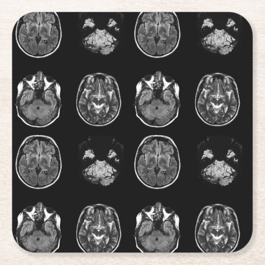 MRT des Gehirns Rechteckiger Pappuntersetzer (Vorderseite)