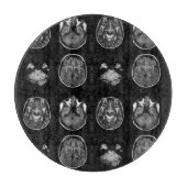 MRT des Gehirns Schneidebrett (Vorderseite)