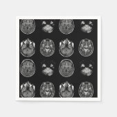 MRT des Gehirns Serviette (Vorderseite)