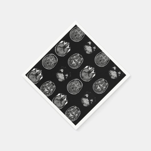 MRT des Gehirns Serviette (Ecke)