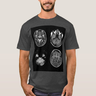 MRT des Gehirns T-Shirt