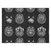 MRT des Gehirns Tischdecke (Vorderseite (Horizontal))