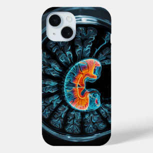 MRT-Gehirnscan Case-Mate iPhone Hülle
