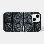 MRT-Gehirnscan iPhone Hülle (Rückseite (Horizontal))