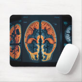 MRT-Gehirnscan Mousepad (Mit Mouse)