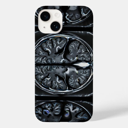 MRT-Gehirnuntersuchung Case-Mate iPhone Hülle (Rückseite)