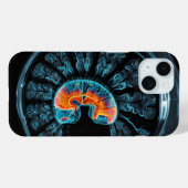 MRT-Gehirnuntersuchung Case-Mate iPhone Hülle (Rückseite (Horizontal))