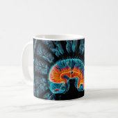 MRT-Gehirnuntersuchung Kaffeetasse (Vorderseite Links)