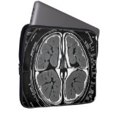 MRT-Gehirnuntersuchung Laptopschutzhülle (Vorne Rechts)