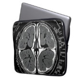 MRT-Gehirnuntersuchung Laptopschutzhülle (Vorderseite Links)