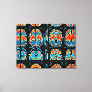 MRT-Gehirnuntersuchung Leinwanddruck