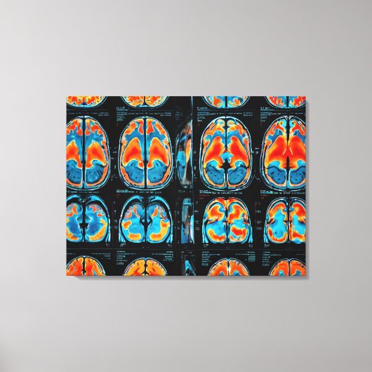 MRT-Gehirnuntersuchung Leinwanddruck (Vorderseite)
