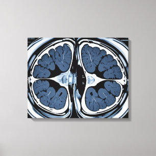 MRT-Gehirnuntersuchung Leinwanddruck