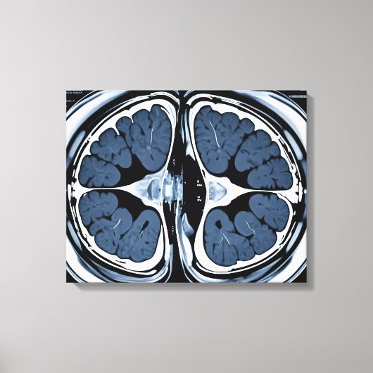 MRT-Gehirnuntersuchung Leinwanddruck (Vorderseite)