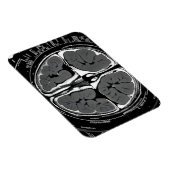 MRT-Gehirnuntersuchung Magnet (Rechte Seite)