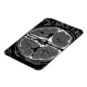MRT-Gehirnuntersuchung Magnet (Linke Seite)