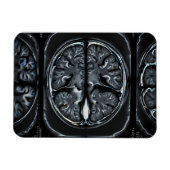 MRT-Gehirnuntersuchung Magnet (Horizontal)