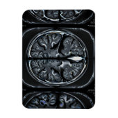 MRT-Gehirnuntersuchung Magnet (Vertikal)