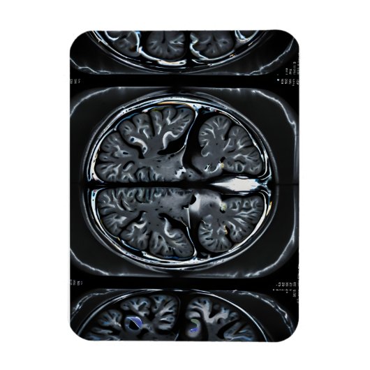 MRT-Gehirnuntersuchung Magnet (Vertikal)