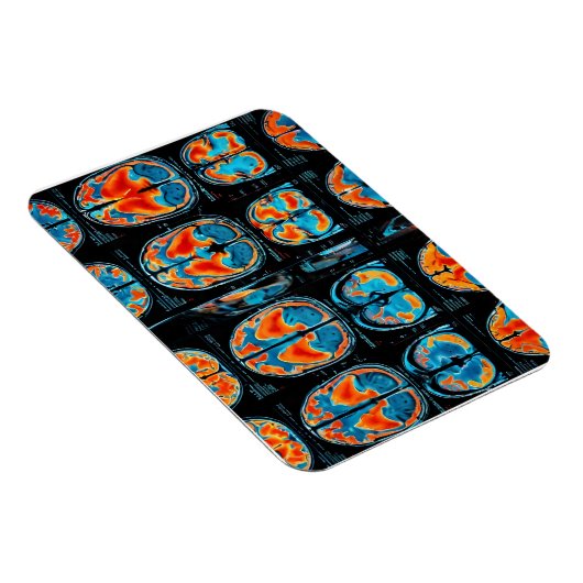 MRT-Gehirnuntersuchung Magnet (Rechte Seite)