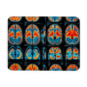 MRT-Gehirnuntersuchung Magnet (Horizontal)