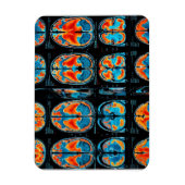 MRT-Gehirnuntersuchung Magnet (Vertikal)